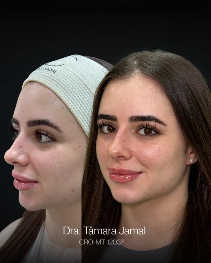 Imagem de paciente | Antes e Depois