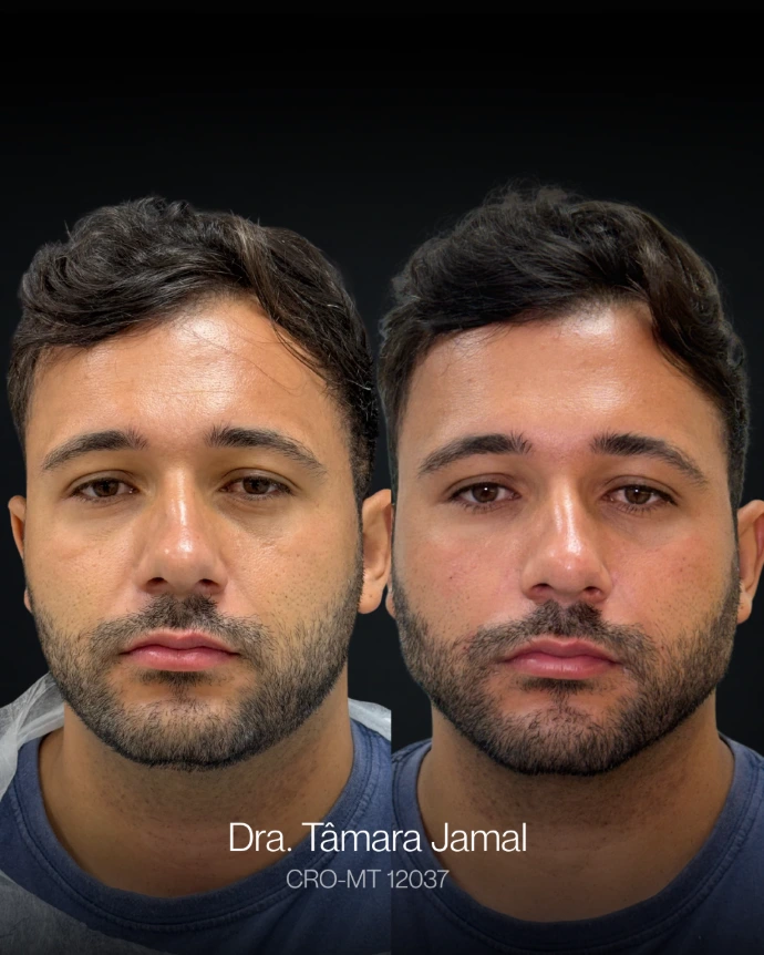 Paciente - Antes e Depois