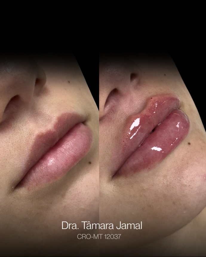 Paciente - Antes e Depois