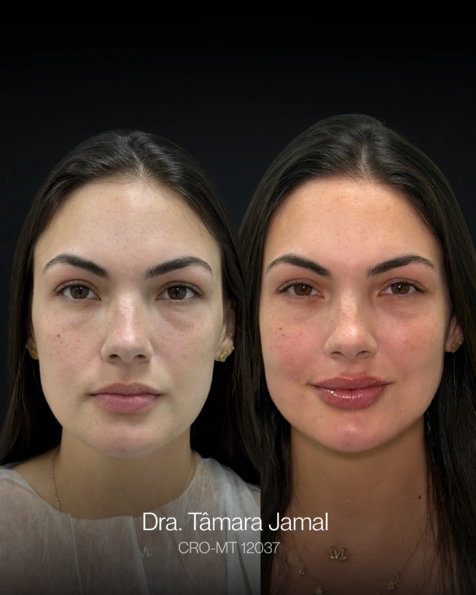 Paciente -  Antes e depois