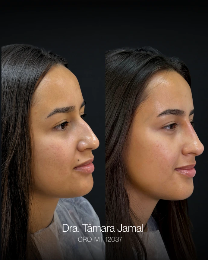 Imagem de paciente | Antes e Depois