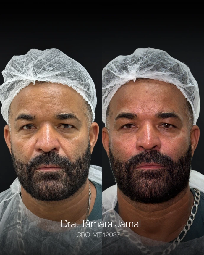 Paciente - Antes e depois