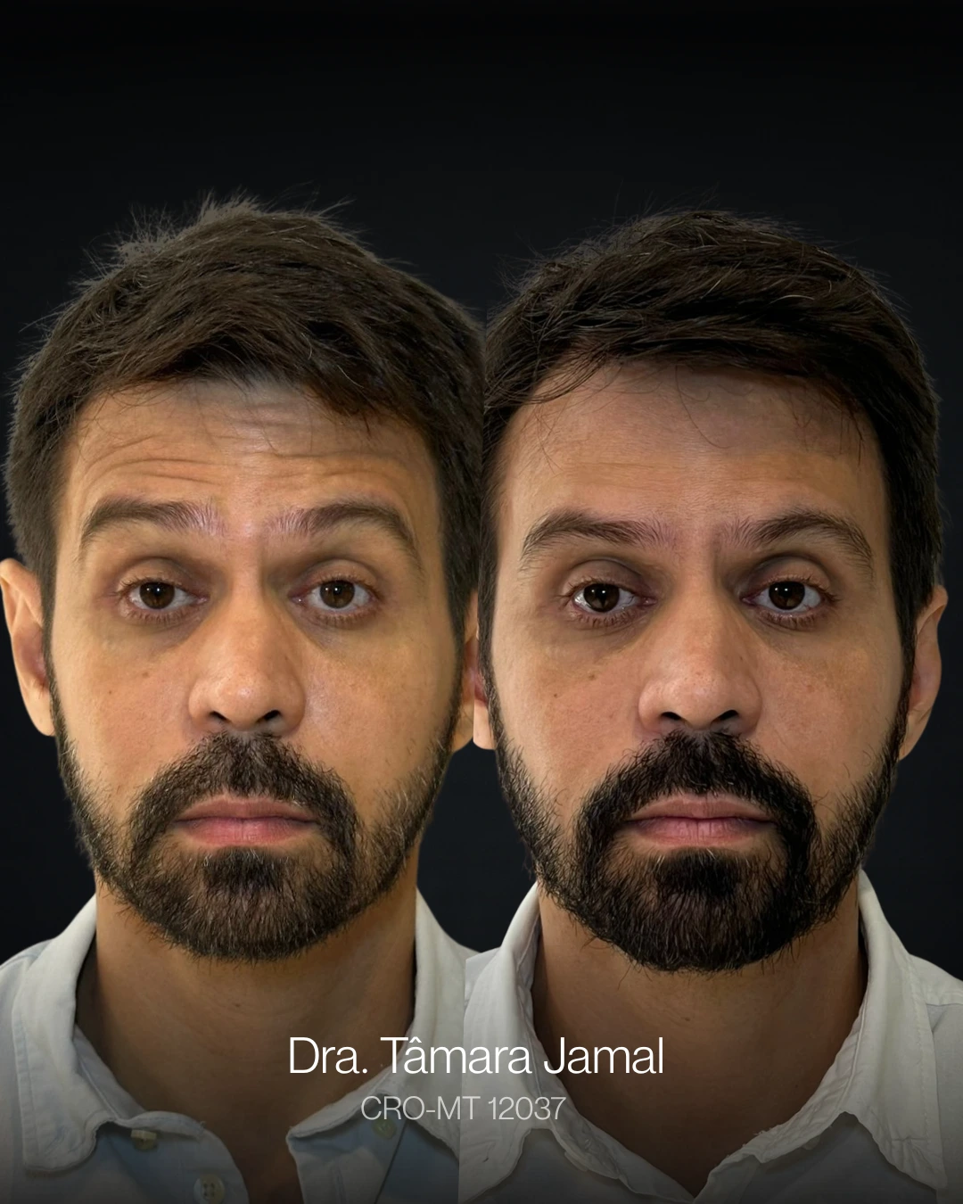 Imagem de paciente | Antes e Depois