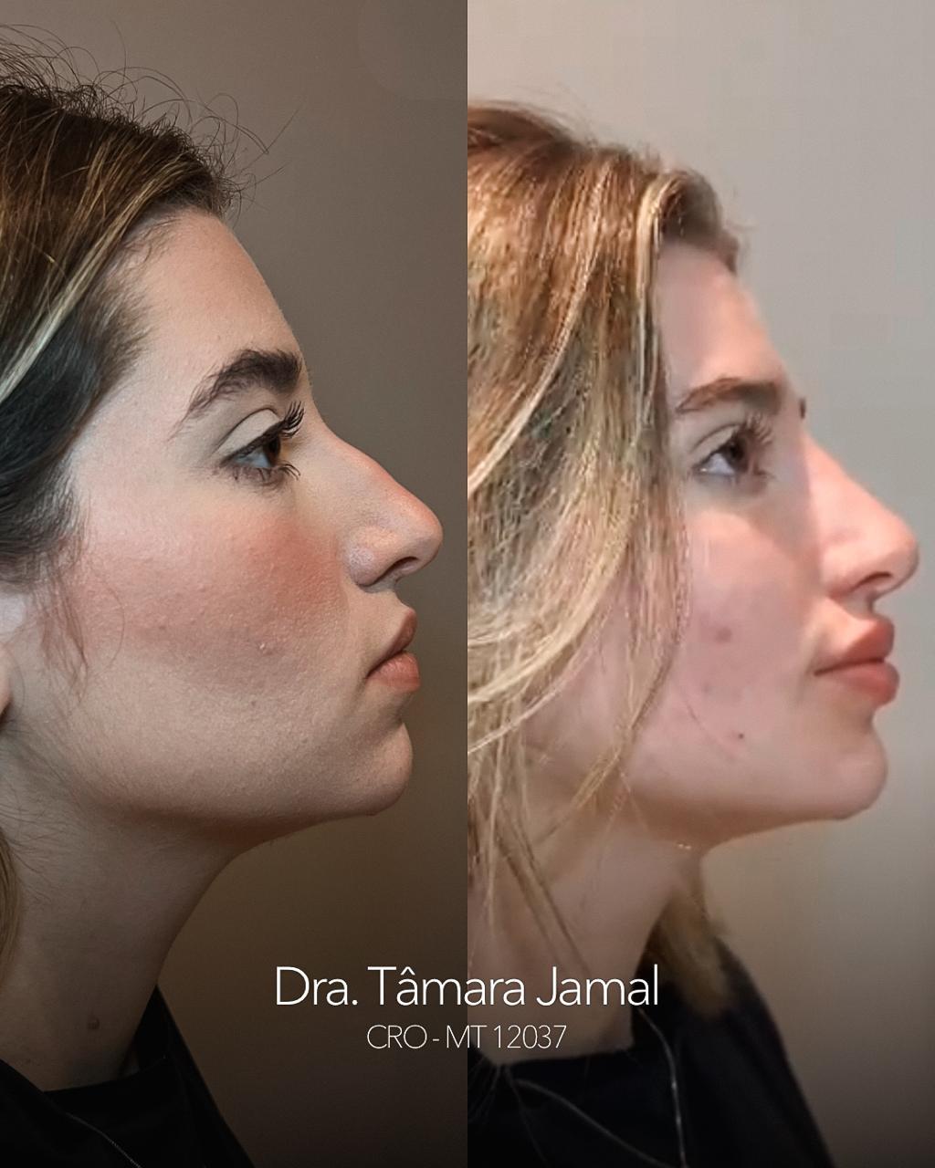 Imagem de paciente | Antes e Depois