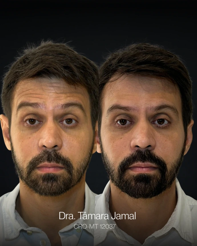 Paciente antes e depois